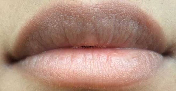 Lighten Lip Pigmentation 