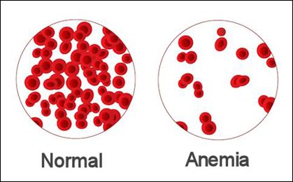 cumin seeds treats anemia
