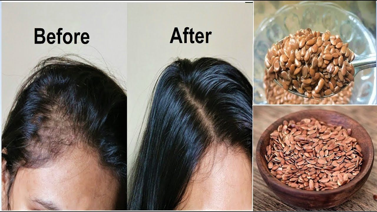 flax seeds for hair growth